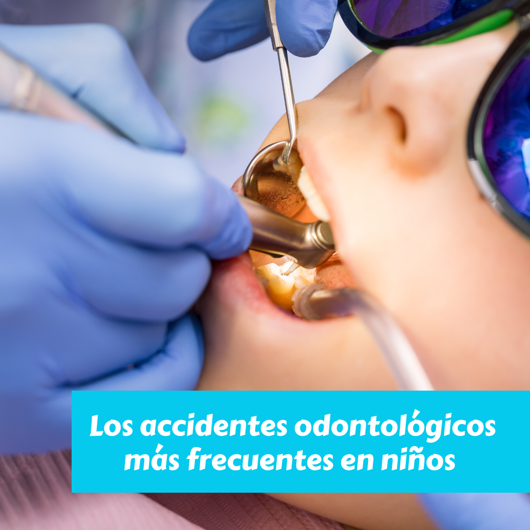 Los accidentes odontológicos más frecuentes en niños y cómo actuar ante ellos