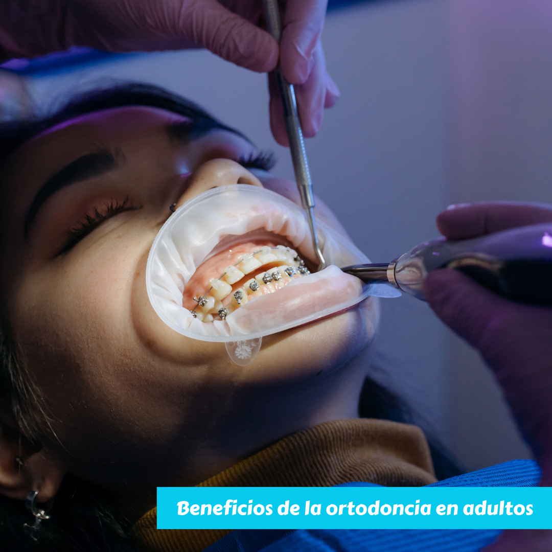 beneficios de la ortodoncia en adultos